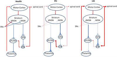 Circuit Mechanisms of L-DOPA-Induced Dyskinesia (LID)